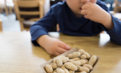 I 10 alimenti che causano più allergie nei bambini
